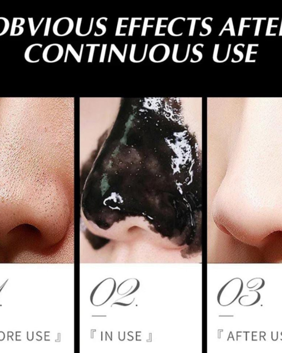 Original Black Head, Pimples Removal Mask.