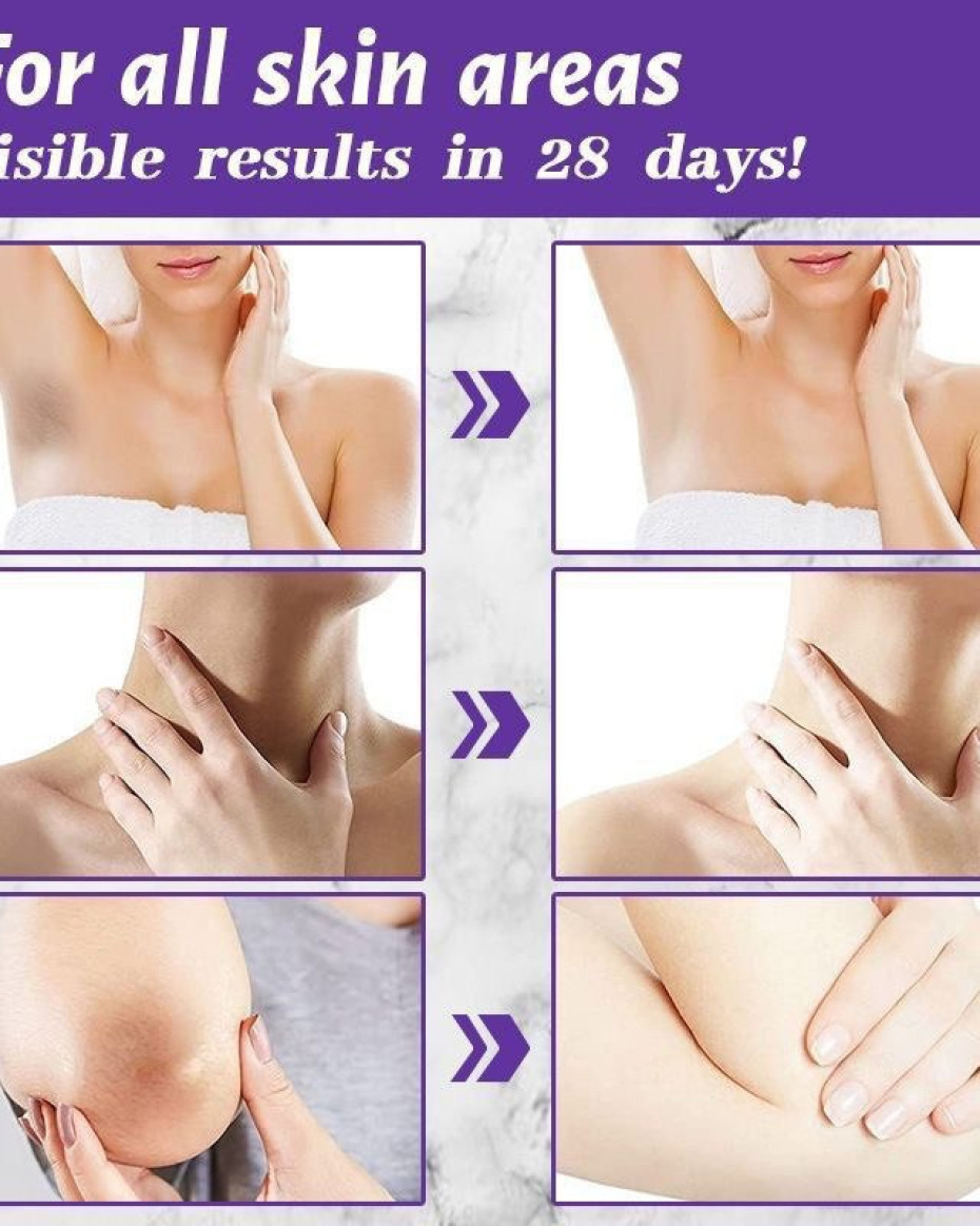 *SKIN WHITENING CAPSULES - CLEARS & EVEN SKIN TONE